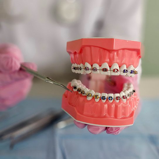 How to Choose the Right Orthodontist in Pennsylvania  - MyOrthodontist - orthodontist in Pennsylvania